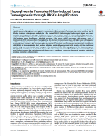 Hyperglycemia Promotes K-Ras-Induced Lung Tumorigenesis through BASCs Amplification