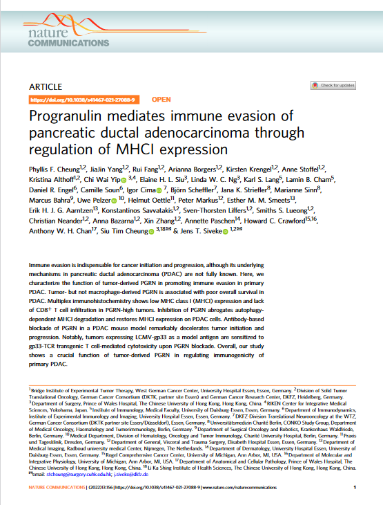 Progranulin mediates immune evasion of pancreatic ductal adenocarcinoma through regulation of MHCI expression