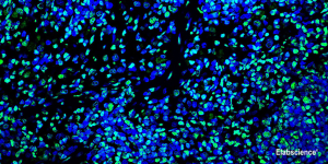 Apoptose