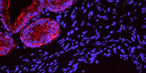 Immunfluoreszenz mit Trueview