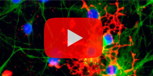Live Webinar von Qkine: Neurobiologische Modellierung mit Stammzellen