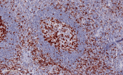 Immun-Checkpoint Marker