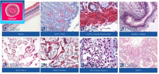 PathPlus Pathologisch validierte Antikörper von LSBio