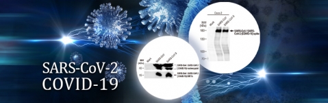 SARS-CoV-2-antibodies_gtx