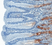 immunohistochemistry