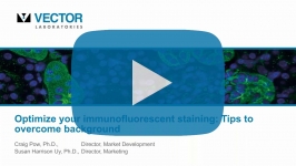 Webinar: Optimieren Sie Ihre Immunfluoreszenzfärbung